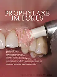 Expertenzirkel: Prophylaxe im Fokus